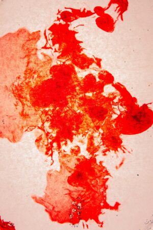 Red blood cells. People with an anemia diagnosis have to worry about this.